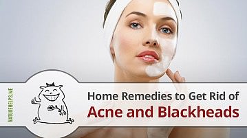 Home Remedies to Get Rid of Acne and Blackheads