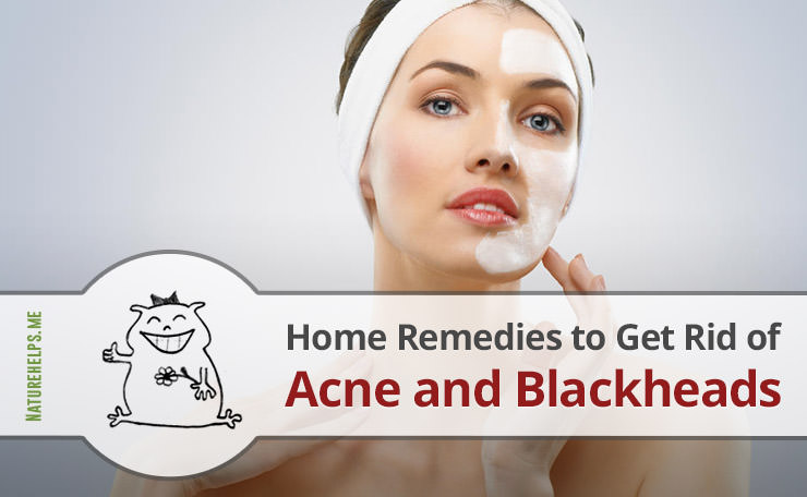 Home Remedies to Get Rid of Acne and Blackheads