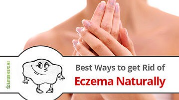 Best Ways to get Rid of Eczema Naturally