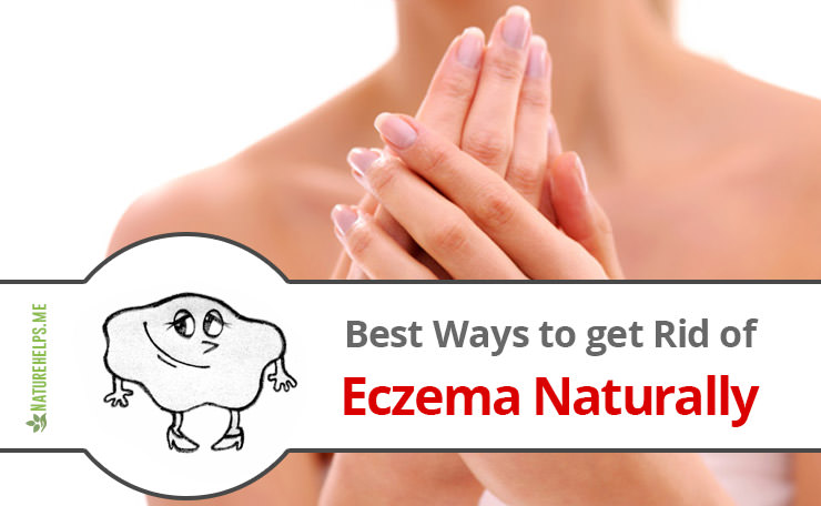 Best Ways to get Rid of Eczema Naturally