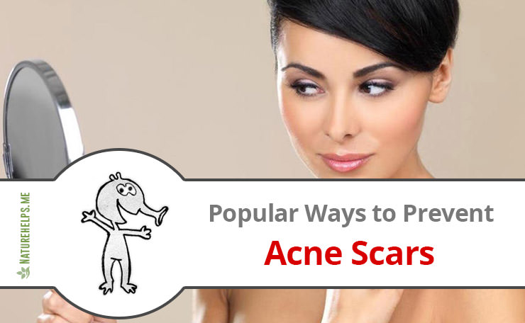Popular Home Remedies to Prevent Acne Scars
