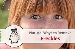 diy-natural-remedy-remove-freckles