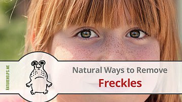 Easy & Natural Ways to Remove Freckles