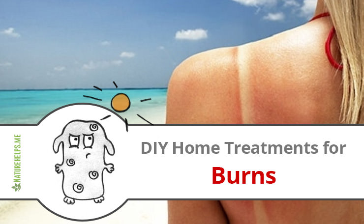 DIY Home Treatments for Burns. Quick Healing and Scarring Prevention