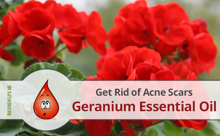 Geranium Essential Oil. Description, Benefits & Uses