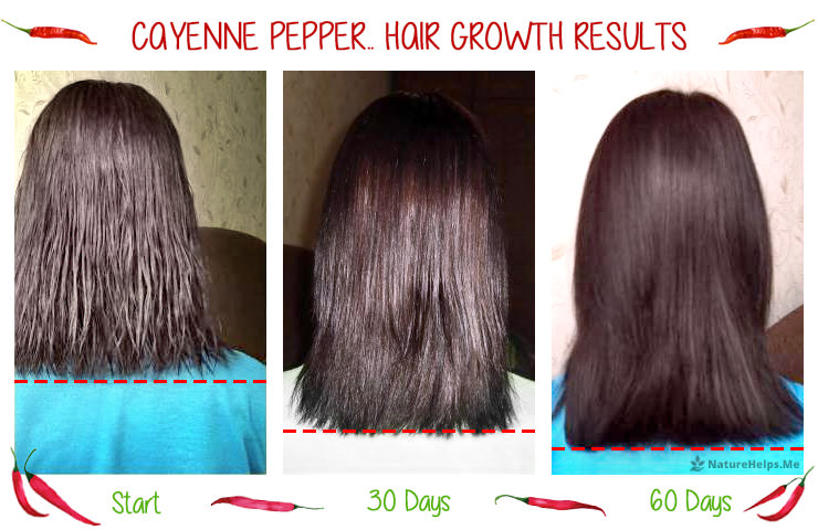 Cayennepfeffer Haarwachstum Ergebnisse. Vorher - Nachher