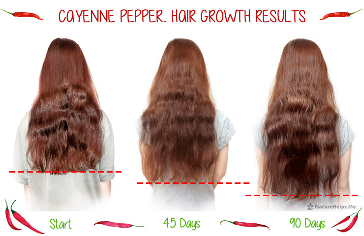 Cayenne Pepper Hair Growth Results. Before and After